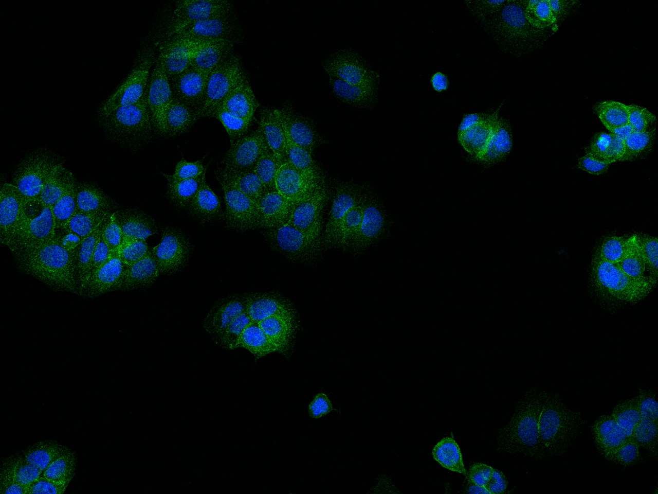 Immunocytochemistry/Immunofluorescence: C11orf52 Antibody [NBP3-12547] - Staining of C11orf52 in MCF7 cells. Cells were fixed with 4% PFA, permeabilzed with 0.3% Triton X-100 in PBS,blocked with 10% serum, and incubated with NBP3-12547 antibody (dilution ratio 1:200) at 4? overnight. Then cells were stained with the Alexa Fluor488-conjugated Goat Anti-rabbit IgG secondary antibody (green) and counterstained with DAPI (blue).Positive staining was localized to Cytoplasm and Cell membrane.