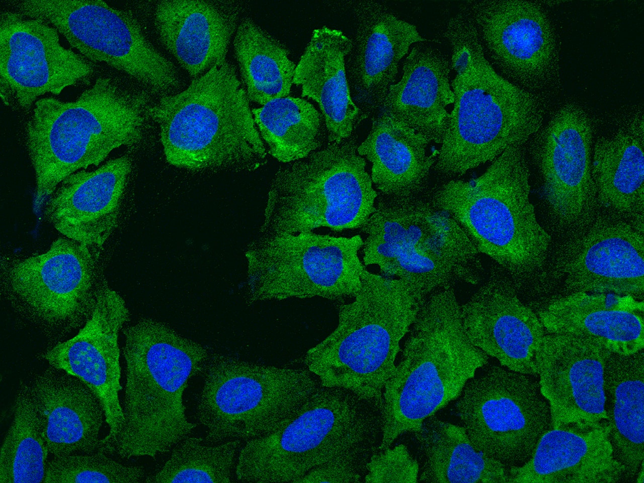 Immunocytochemistry/ Immunofluorescence: RPS14 Antibody - BSA Free [NBP3-12555] - Immunofluorescence staining of RPS14 in U2OS cells. Cells were fixed with 4% PFA, permeabilzed with 0.3% Triton X-100 in PBS,blocked with 10% serum, and incubated with NBP3-12555 (dilution ratio 1:200) at 4 overnight. Then cells were stained with the Alexa Fluor488-conjugated Goat Anti-rabbit IgG secondary antibody (green) and counterstained with DAPI (blue).Positive staining was localized to Cytoplasm.
