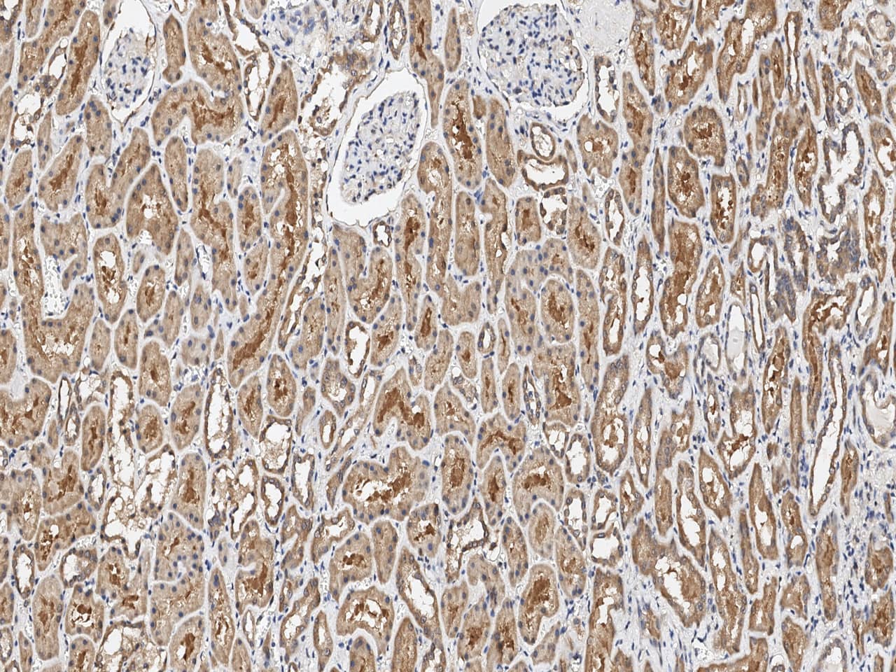 Immunohistochemistry-Paraffin: EIF3F Antibody - BSA Free [NBP3-12558] - Immunochemical staining of human EIF3F in human kidney with NBP3-12558 at 1:100 dilution, formalin-fixed paraffin embedded sections.