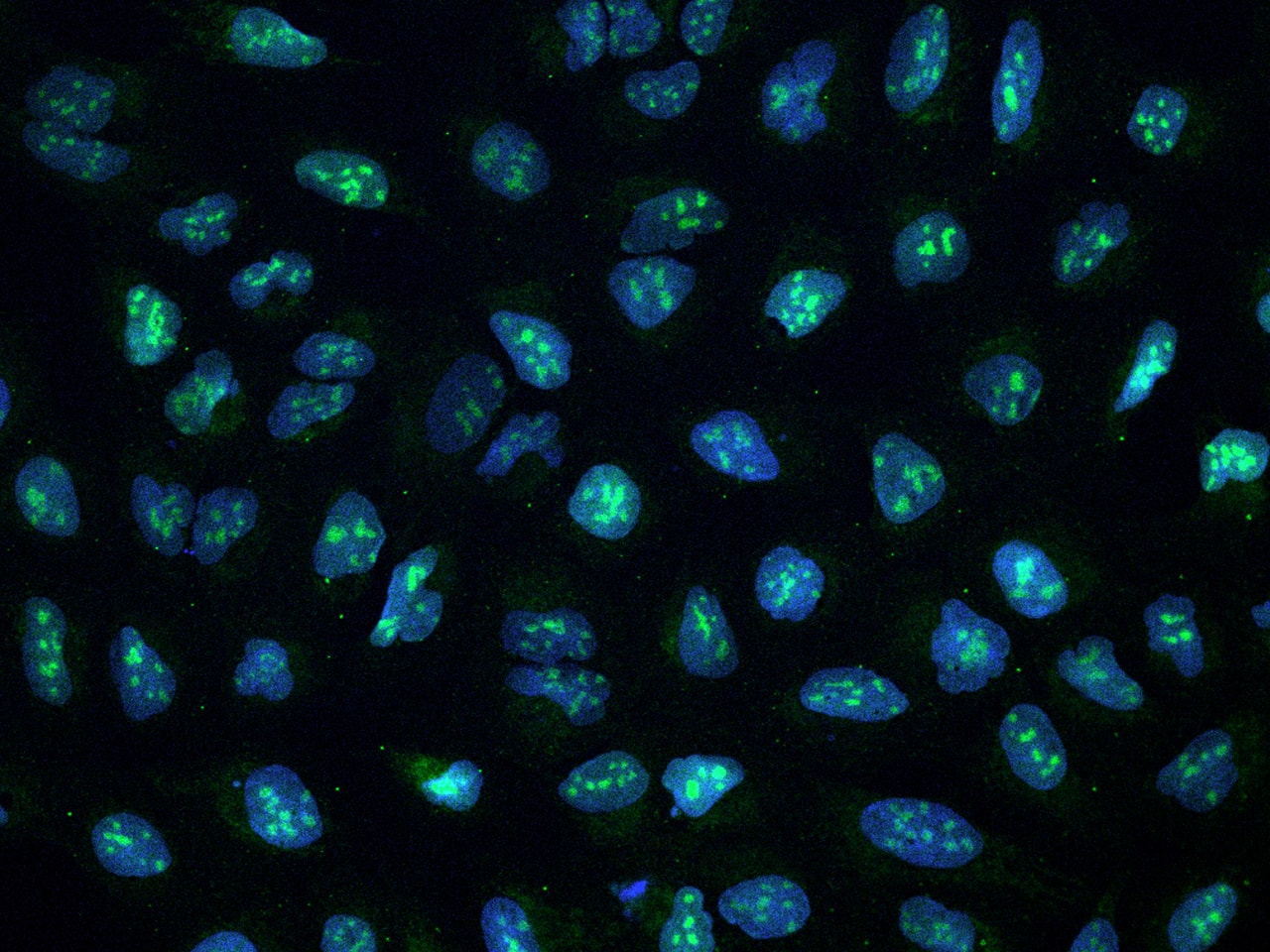 Immunocytochemistry/Immunofluorescence: CCDC137 Antibody [NBP3-12572] - Staining of CCDC137 in U2OS cells. Cells were fixed with 4% PFA, permeabilzed with 0.1% Triton X-100 in PBS,blocked with 10% serum, and incubated with NBP3-12572 antibody (dilution ratio 1:200) at 4? overnight. Then cells were stained with the Alexa Fluor488-conjugated Goat Anti-rabbit IgG secondary antibody (green) and counterstained with DAPI (blue).Positive staining was localized to Nucleus.