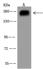 Western Blot: PARG1 Antibody - BSA Free [NBP3-12573] - NBP3-12573 at 1:500 dilution Lane A: HeLa Whole Cell Lysate Lysates/proteins at 30 ug per lane. Secondary Goat Anti-Rabbit IgG (H+L)/HRP at 1/10000 dilution. Developed using the ECL technique. Performed under reducing conditions. Predicted band size:142 kDa Observed band size:170 kDa 