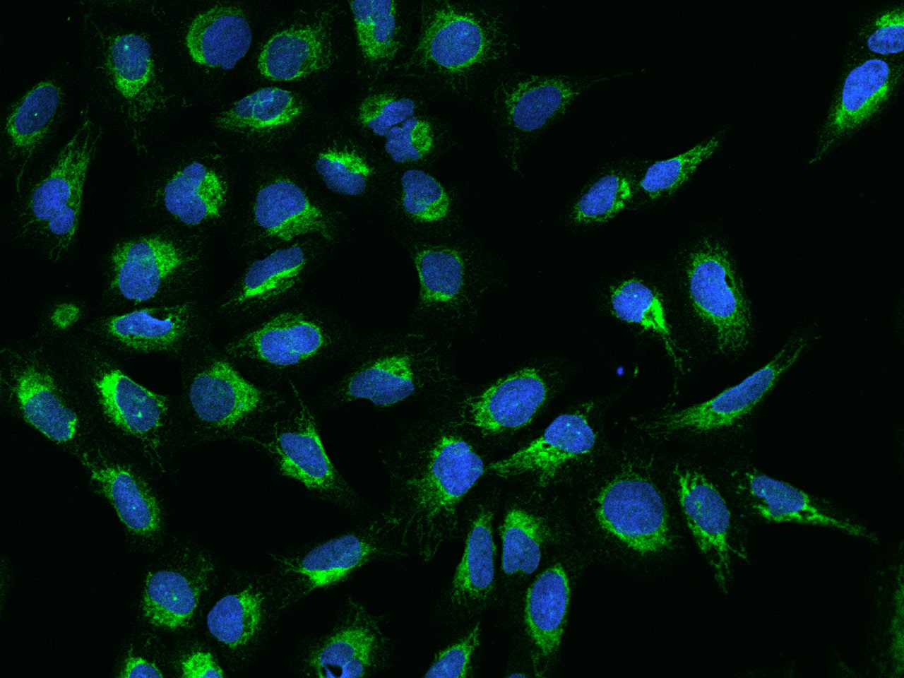 Immunocytochemistry/Immunofluorescence: PTRH2 Antibody [NBP3-12579] - Staining of PTRH2 in U2OS cells. Cells were fixed with 4% PFA, permeabilzed with 0.1% Triton X-100 in PBS,blocked with 10% serum, and incubated with NBP3-12579 antibody (dilution ratio 1:200) at 4? overnight. Then cells were stained with the Alexa Fluor488-conjugated Goat Anti-rabbit IgG secondary antibody (green) and counterstained with DAPI (blue).Positive staining was localized to Cytoplasm.