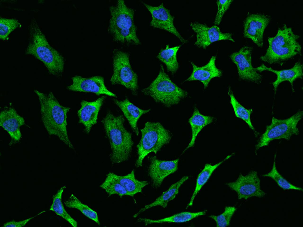 Immunocytochemistry/Immunofluorescence: RPL29 Antibody [NBP3-12600] - Staining of RPL29 in HeLa cells. Cells were fixed with 4% PFA, permeabilzed with 0.1% Triton X-100 in PBS,blocked with 10% serum, and incubated with NBP3-12600 antibody (dilution ratio 1:200) at 4? overnight. Then cells were stained with the Alexa Fluor488-conjugated Goat Anti-rabbit IgG secondary antibody (green) and counterstained with DAPI (blue).Positive staining was localized to Cytoplasm.