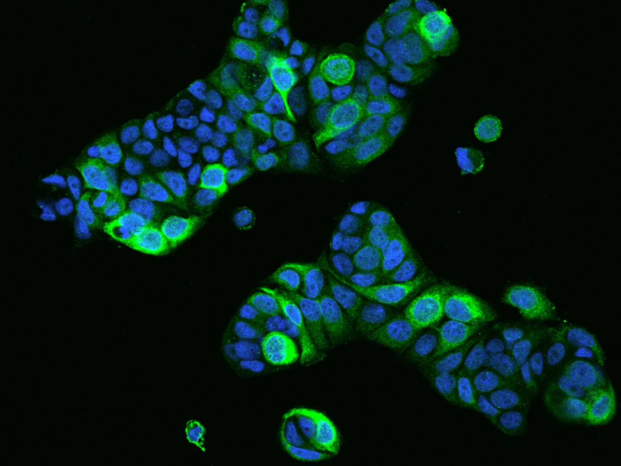 Immunocytochemistry/ Immunofluorescence PRR11 Antibody - BSA Free