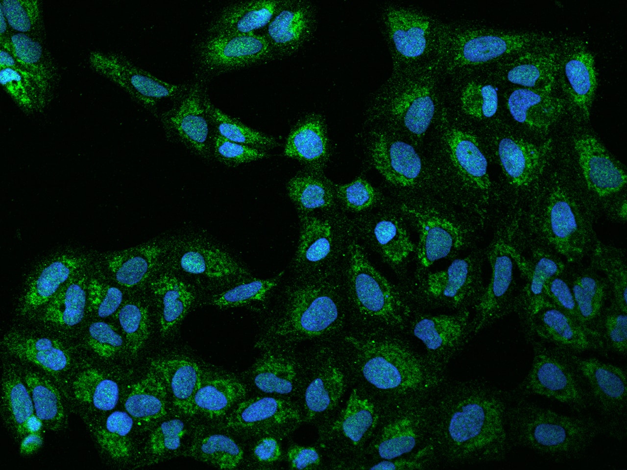 Immunocytochemistry/ Immunofluorescence TIMM29 Antibody - BSA Free