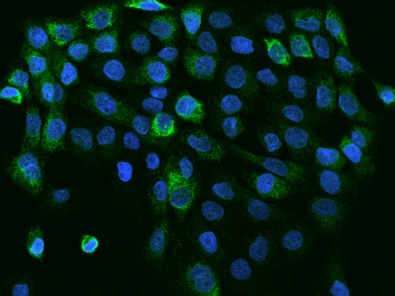 Immunocytochemistry/ Immunofluorescence CC2D1A Antibody - BSA Free
