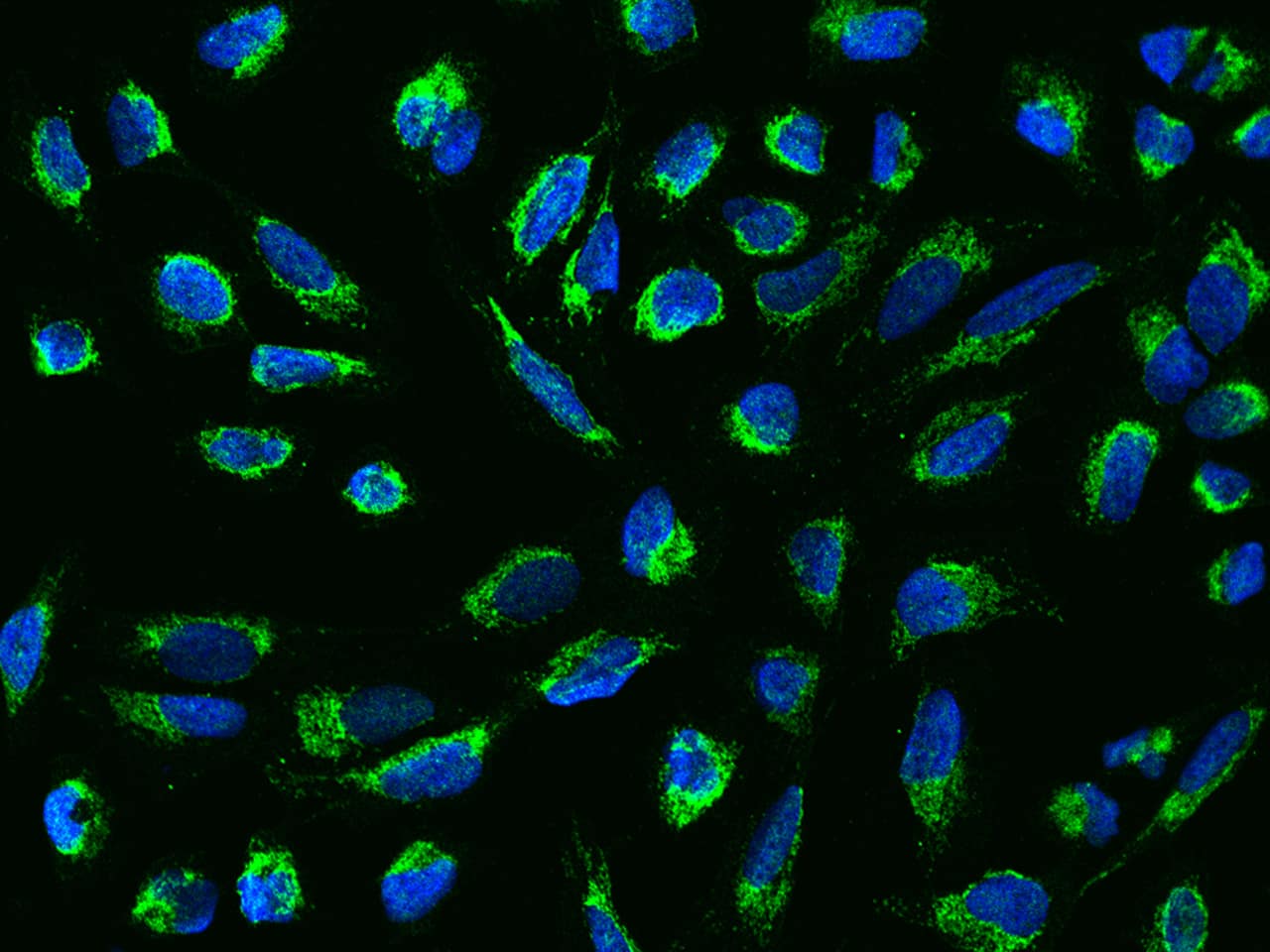 Immunocytochemistry/Immunofluorescence: Mitochondrial ribonuclease P protein 3 Antibody [NBP3-12679] - Staining of MRPP3 in U2OS cells. Cells were fixed with 4% PFA, permeabilzed with 0.3% Triton X-100 in PBS,blocked with 10% serum, and incubated with NBP3-12679 antibody (dilution ratio 1:200) at 4? overnight. Then cells were stained with the Alexa Fluor488-conjugated Goat Anti-rabbit IgG secondary antibody (green) and counterstained with DAPI (blue).Positive staining was localized to Cytoplasm.
