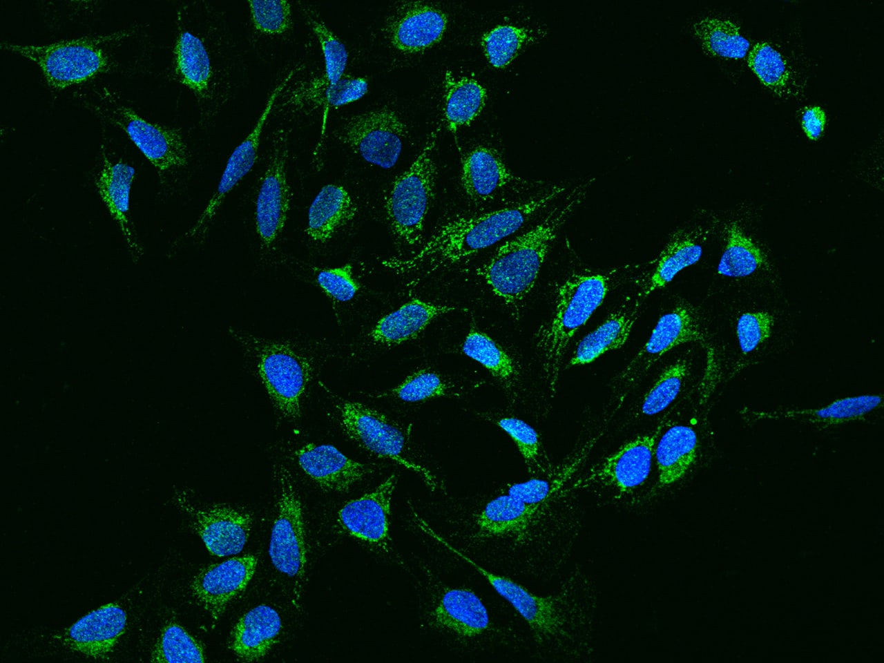 Immunocytochemistry/Immunofluorescence: NDUFB11 Antibody [NBP3-12681] - Staining of NDUFB11 in U2OS cells. Cells were fixed with 4% PFA, permeabilzed with 0.3% Triton X-100 in PBS,blocked with 10% serum, and incubated with NBP3-12681 antibody (dilution ratio 1:200) at 4? overnight. Then cells were stained with the Alexa Fluor488-conjugated Goat Anti-rabbit IgG secondary antibody (green) and counterstained with DAPI (blue).Positive staining was localized to Cytoplasm.