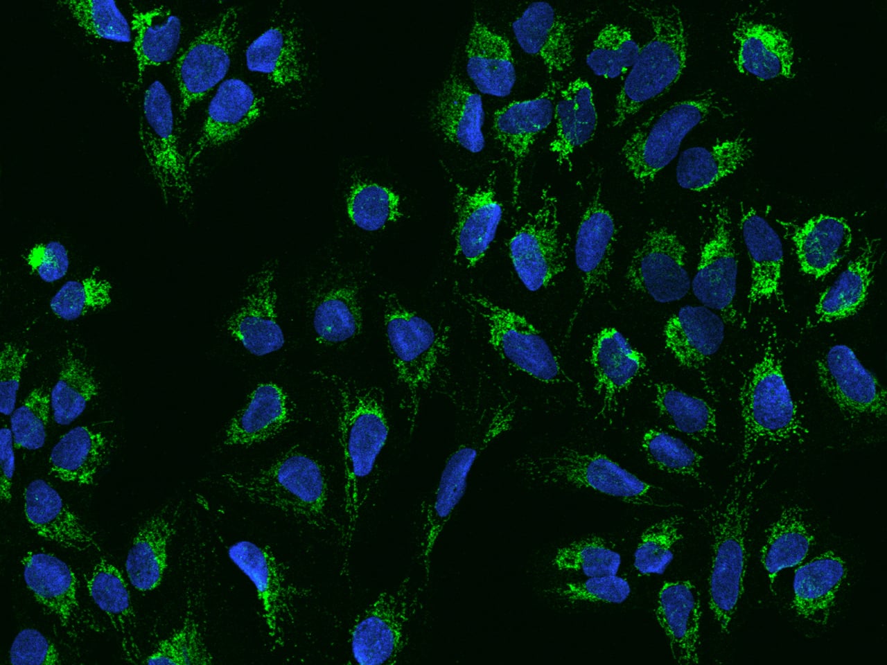 Immunocytochemistry/Immunofluorescence: ACOT1 Antibody [NBP3-12713] - Staining of ACOT1 in U2OS cells. Cells were fixed with 4% PFA, permeabilzed with 0.3% Triton X-100 in PBS,blocked with 10% serum, and incubated with NBP3-12713 antibody (dilution ratio 1:200) at 4? overnight. Then cells were stained with the Alexa Fluor488-conjugated Goat Anti-rabbit IgG secondary antibody (green) and counterstained with DAPI (blue).Positive staining was localized to Cytoplasm.