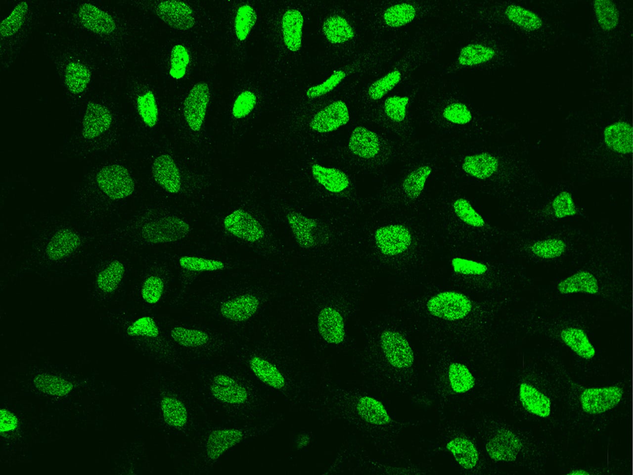 Immunocytochemistry/ Immunofluorescence ARID2 Antibody - BSA Free