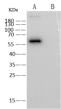 NBP3-12741 used at 1 ug/mL. Lane A: H3N2 (A/Darwin/9/2021)/(A/Darwin/6/2021) NP Protein. Lane B: Influenza B (B/Austria/1359417/2021) NP Protein. Secondary Goat Anti-Rabbit IgG (H+L)[HRP] used at at 1/10000 dilution. Developed using the ECL technique. Performed under reducing conditions.