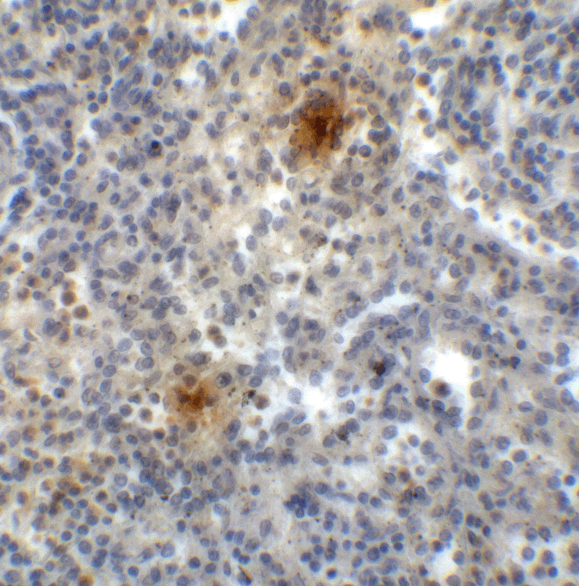 Immunohistochemistry: TIGIT Antibody (2B5) - VHH - Azide and BSA Free [NBP3-12831] - Immunohistochemistry of TIGIT in human spleen tissue with TIGIT single domain antibody at 1 ug/mL. 