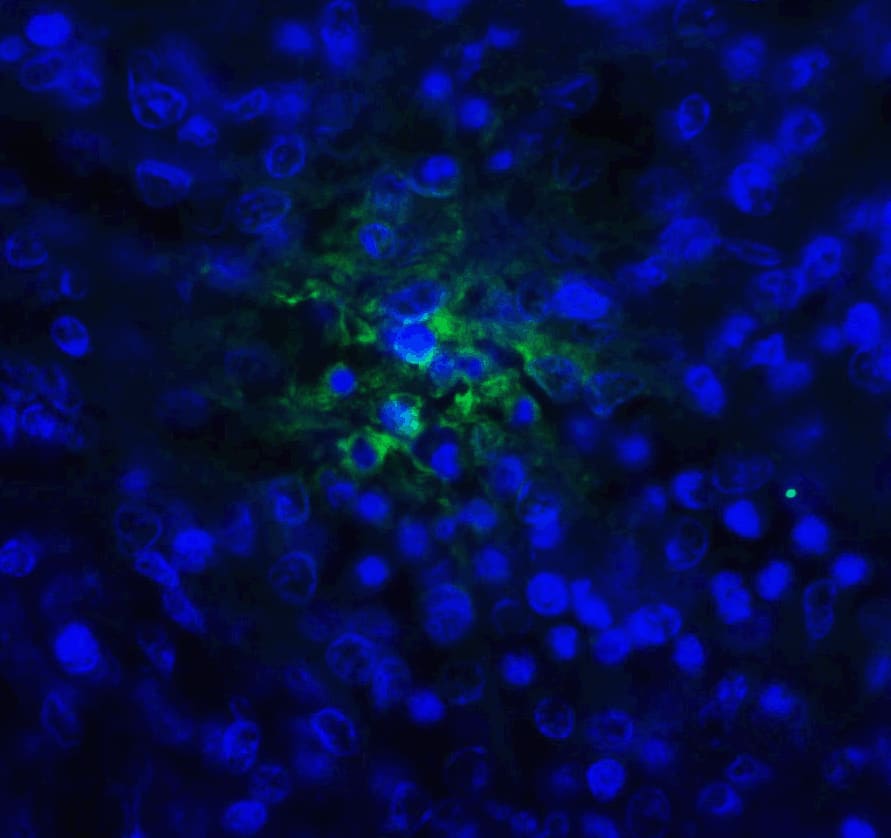 Immunocytochemistry/ Immunofluorescence: TIGIT Antibody (2B5) - VHH - Azide and BSA Free [NBP3-12831] - Immunofluorescence of TIGIT in human spleen tissue with TIGIT single domain antibody at 20 ug/mL. 