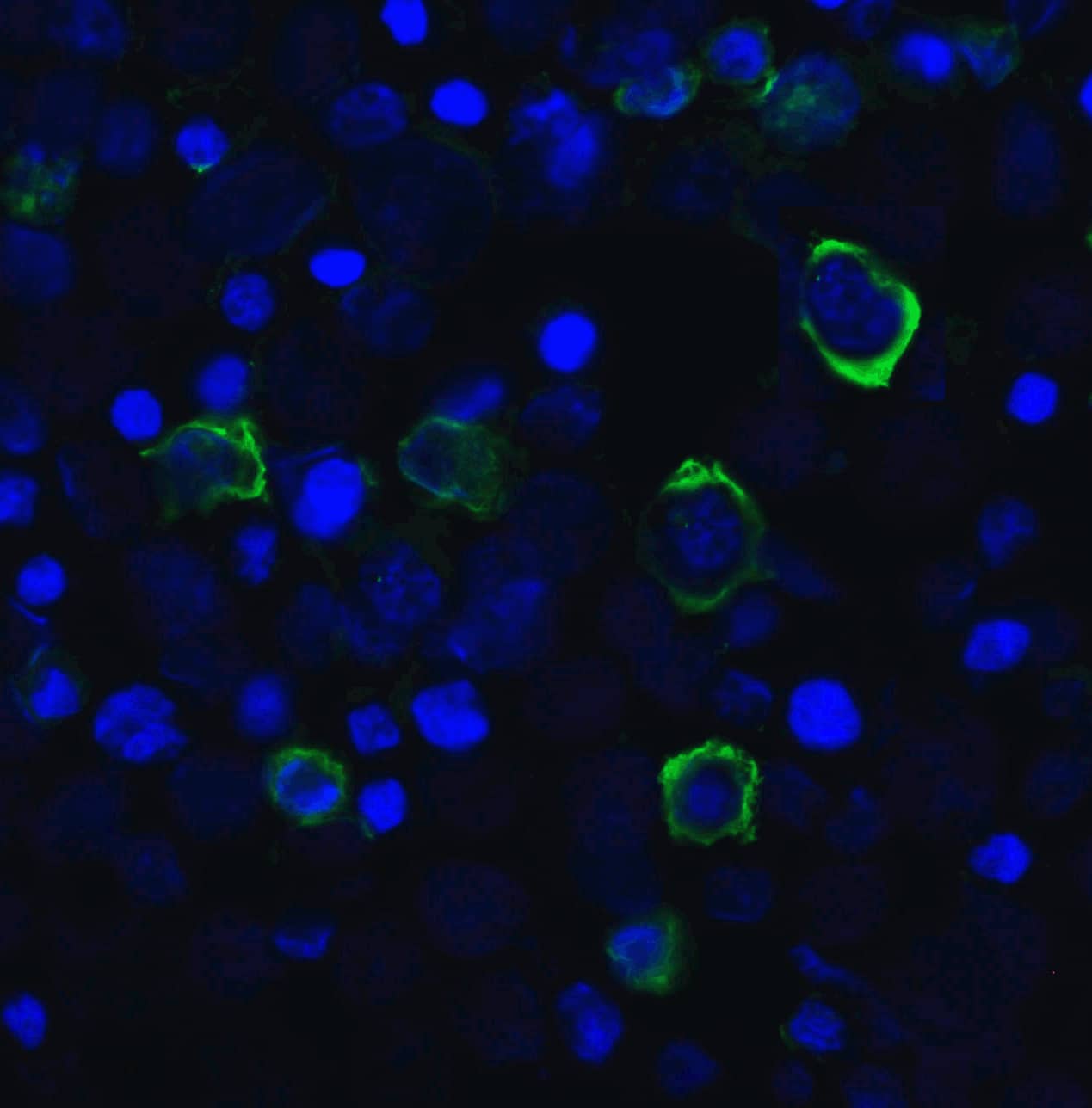 Immunocytochemistry/ Immunofluorescence: TIGIT Antibody (2B5) - VHH - Azide and BSA Free [NBP3-12831] - Immunofluorescence of TIGIT in transfected HEK293 cells with TIGIT single domain antibody at 20 ug/mL. 