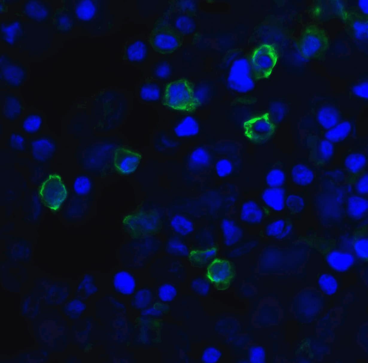 Immunocytochemistry/ Immunofluorescence: TIGIT Antibody (2F7) - VHH - Azide and BSA Free [NBP3-12832] - Immunofluorescence of TIGIT in transfected HEK293 cells with TIGIT single domain antibody at 20 ug/mL. 