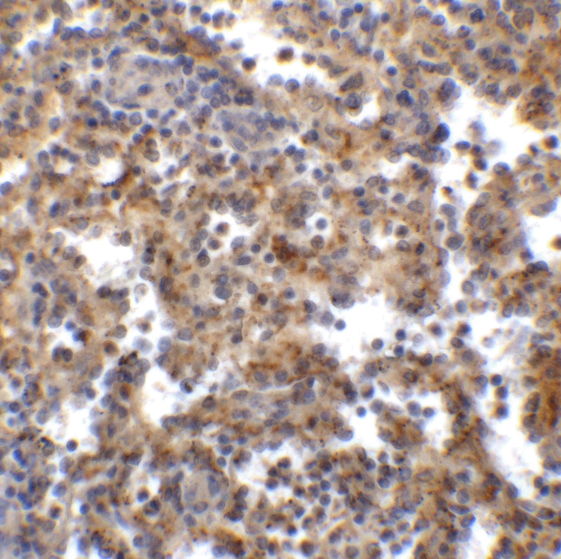 Immunohistochemistry: TIGIT Antibody (2C7) - VHH - Azide and BSA Free [NBP3-12834] - Immunohistochemistry of TIGIT in human spleen tissue with TIGIT single domain antibody at 1 ug/mL. 