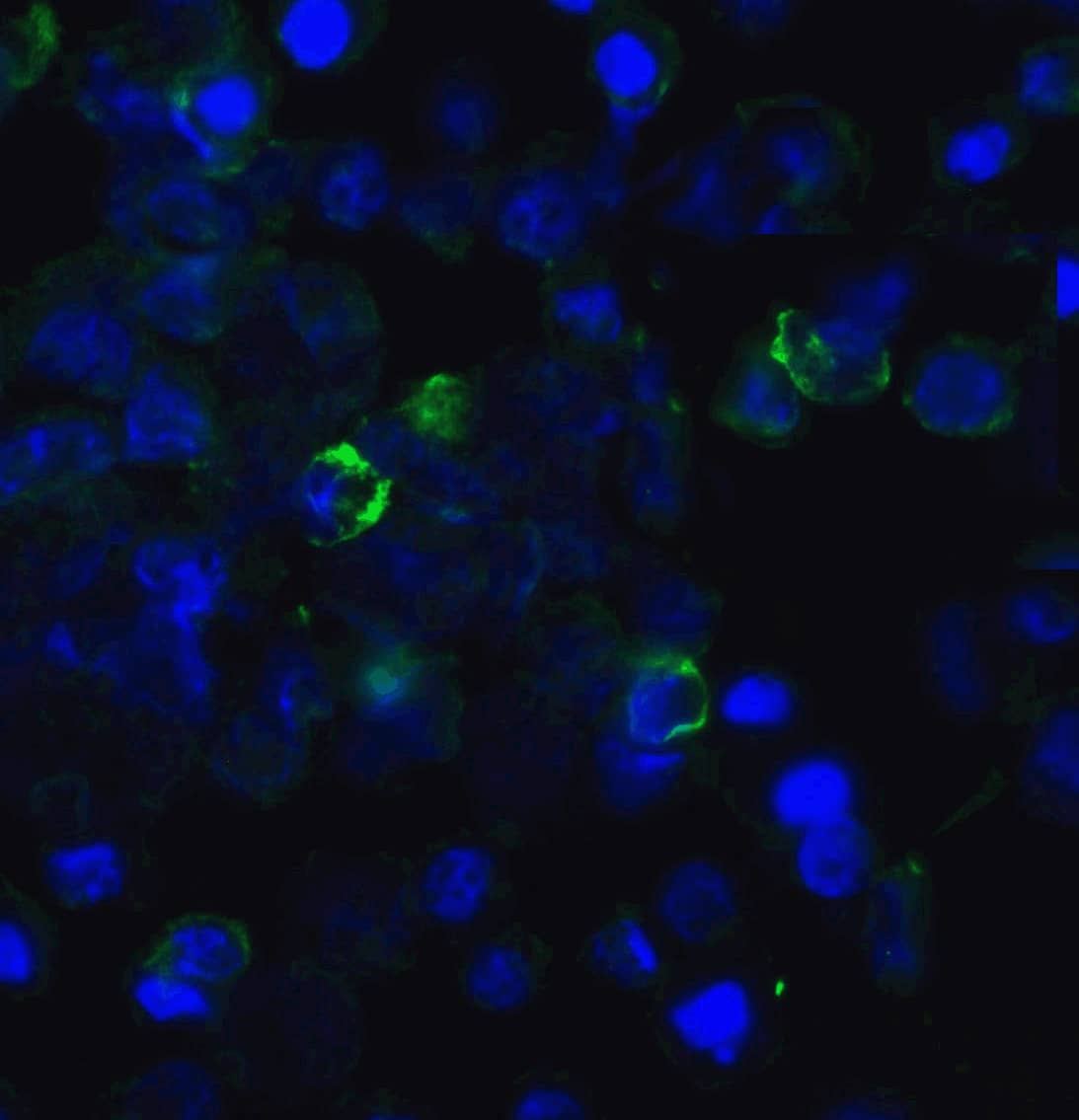 Immunocytochemistry/ Immunofluorescence: TIGIT Antibody (2C7) - VHH - Azide and BSA Free [NBP3-12834] - Immunofluorescence of TIGIT in transfected HEK293 cells with TIGIT single domain antibody at 20 ug/mL. 