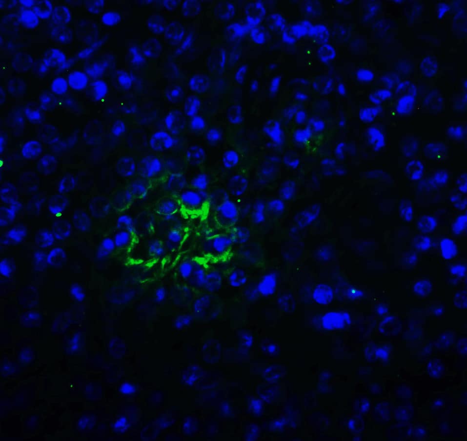 Immunocytochemistry/ Immunofluorescence: TIGIT Antibody (2D7) - VHH - Azide and BSA Free [NBP3-12835] - Immunofluorescence of TIGIT in human spleen tissue with TIGIT single domain antibody at 20 ug/mL. 