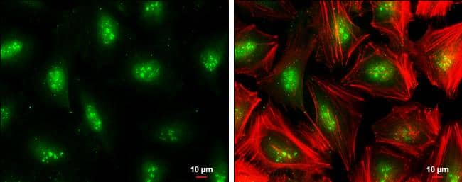 TCF7L2 antibody detects TCF7L2 protein at nucleus by immunofluorescent analysis.Sample: HeLa cells were fixed in 4% paraformaldehyde at RT for 15 min.Green: TCF7L2 protein stained by TCF7L2 antibody (NBP3-12873) diluted at 1:500.Red: Phalloidin, a cytoskeleton marker, diluted at 1:100.Scale bar = 10 um. 