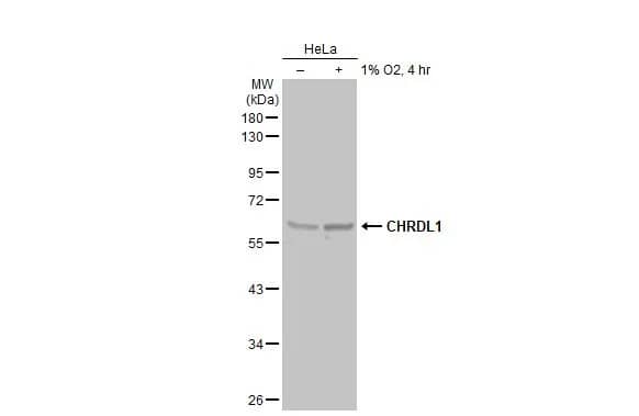 Western Blot: Chordin-like 1/CHRDL1 Antibody [NBP3-12874] - Untreated (-) and treated (+) HeLa whole cell extracts (30 ug) were separated by 10% SDS-PAGE, and the membrane was blotted with Chordin-like 1/CHRDL1 antibody (NBP3-12874) diluted at 1:5000. The HRP-conjugated anti-rabbit IgG antibody  was used to detect the primary antibody.