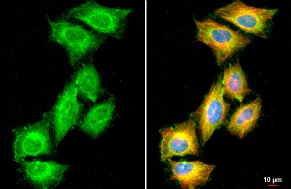 Immunocytochemistry/ Immunofluorescence: Chordin-like 1/CHRDL1 Antibody [NBP3-12874] - Chordin-like 1/CHRDL1 antibody detects Chordin-like 1/CHRDL1 protein at cytoplasm by immunofluorescent analysis.Sample: HeLa cells were fixed in 4% paraformaldehyde at RT for 15 min.Green: Chordin-like 1/CHRDL1 stained by Chordin-like 1/CHRDL1 antibody (NBP3-12874) diluted at 1:500.Red: alpha Tubulin, a cytoskeleton marker, stained by alpha Tubulin antibody [GT114]  diluted at 1:1000.Blue: Fluoroshield with DAPI .Scale bar= 10um.