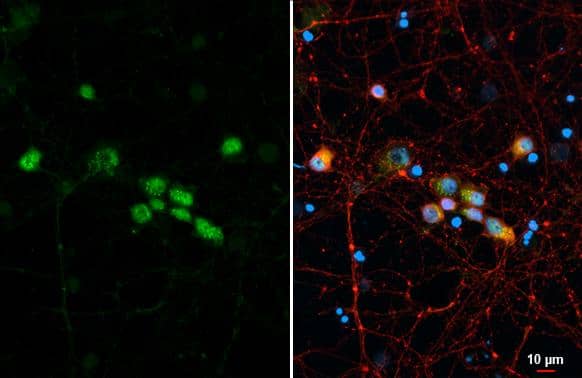 LIM1 antibody detects LIM1 protein at cytoplasm and nucleus by immunofluorescent analysis.Sample: DIV9 rat E18 primary cortical neuron cells were fixed in 4% paraformaldehyde at RT for 15 min.Green: LIM1 stained by LIM1 antibody (NBP3-12886) diluted at 1:250.Red: Tau, an axon marker, stained by Tau antibody [GT287]  diluted at 1:500.Blue: Fluoroshield with DAPI . 