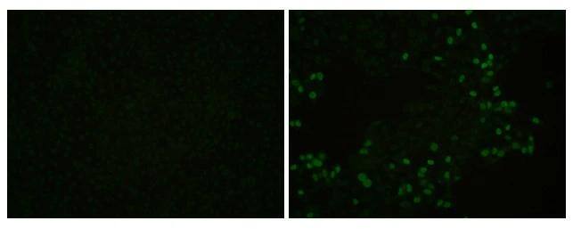 Immunofluorescent analysis of PRRSV infected Marc-145 cells using PRRS Virus Nucleocapsid protein antibody . Sample: Marc-145 cells mock (left) and infected with North American (type II) genotypes PRRSV (right) were fixed in 4% formaldehyde at 4C for 10 min. Green: PRRS Virus Nucleocapsid protein stained by PRRS Virus Nucleocapsid protein antibody (NBP3-12889) diluted at 1:1000. 