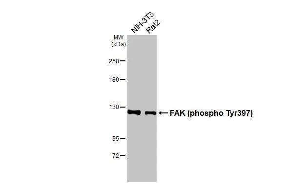 Various whole cell extracts (30 ug) were separated by 5% SDS-PAGE, and the membrane was blotted with FAK (phospho Tyr397) antibody (NBP3-12897) diluted at 1:500. The HRP-conjugated anti-rabbit IgG antibody  was used to detect the primary antibody. 