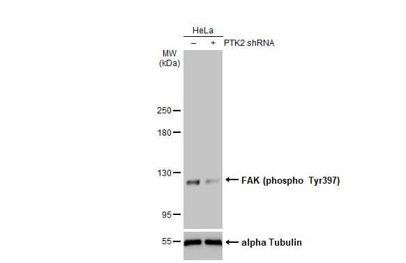 <b>Genetic Strategies Validation. </b>Non-transfected (-) and transfected (+) HeLa whole cell extracts (30 ug) were separated by 5% SDS-PAGE, and the membrane was blotted with FAK (phospho Tyr397) antibody (NBP3-12897) diluted at 1:500. The HRP-conjugated anti-rabbit IgG antibody  was used to detect the primary antibody. 