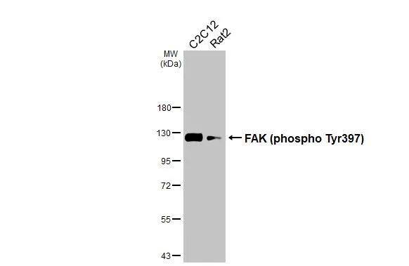 Various whole cell extracts (30 ug) were separated by 7.5% SDS-PAGE, and the membrane was blotted with FAK (phospho Tyr397) antibody (NBP3-12897) diluted at 1:500. The HRP-conjugated anti-rabbit IgG antibody  was used to detect the primary antibody. 