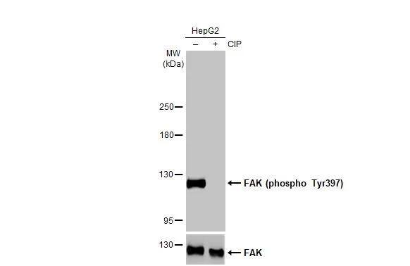 Untreated (-) and treated (+) HepG2 whole cell extracts (30 ug) were separated by 5% SDS-PAGE, and the membrane was blotted with FAK (phospho Tyr397) antibody (NBP3-12897) diluted at 1:500. The HRP-conjugated anti-rabbit IgG antibody  was used to detect the primary antibody. 