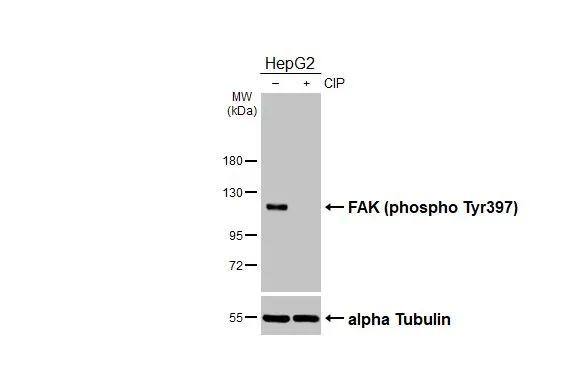 Untreated (-) and treated (+) HepG2 whole cell extracts (30 ug) were separated by 7.5% SDS-PAGE, and the membrane was blotted with FAK (phospho Tyr397) antibody (NBP3-12897) diluted at 1:500. The HRP-conjugated anti-rabbit IgG antibody  was used to detect the primary antibody. 