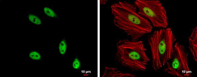 SOX8 antibody detects SOX8 protein at nucleus by immunofluorescent analysis.Sample: HeLa cells were fixed in 4% paraformaldehyde at RT for 15 min.Green: SOX8 protein stained by SOX8 antibody (NBP3-12898) diluted at 1:500.Red: Phalloidin, a cytoskeleton marker, diluted at 1:200.Scale bar = 10 um. 