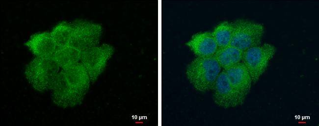 Immunocytochemistry/ Immunofluorescence VPS18 Antibody - BSA Free