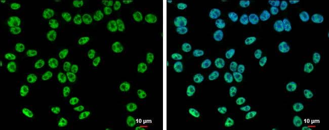 SETD1A antibody detects SETD1A protein at nucleus by immunofluorescent analysis.Sample: 293T cells were fixed in 4% paraformaldehyde at RT for 15 min.Green: SETD1A protein stained by SETD1A antibody (NBP3-12907) diluted at 1:500.Blue: Hoechst 33342 staining.Scale bar = 10 um. 