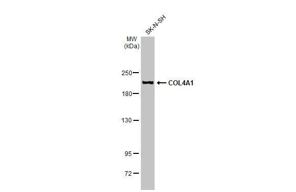 Whole cell extract (30 ug) was separated by 5% SDS-PAGE, and the membrane was blotted with COL4A1 antibody (NBP3-12908) diluted at 1:1000. The HRP-conjugated anti-rabbit IgG antibody  was used to detect the primary antibody. 