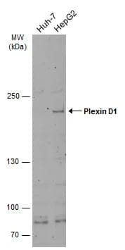 Various whole cell extracts (30 ug) were separated by 5% SDS-PAGE, and the membrane was blotted with Plexin D1 antibody (NBP3-12915) diluted at 1:500. The HRP-conjugated anti-rabbit IgG antibody  was used to detect the primary antibody, and the signal was developed with Trident ECL plus-Enhanced. 