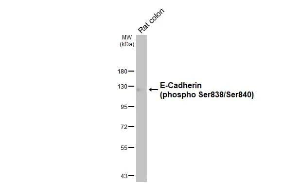 Rat tissue extract (50 ug) was separated by 7.5% SDS-PAGE, and the membrane was blotted with E-Cadherin (phospho Ser838/840) antibody (NBP3-12922) diluted at 1:10000. The HRP-conjugated anti-rabbit IgG antibody  was used to detect the primary antibody. 