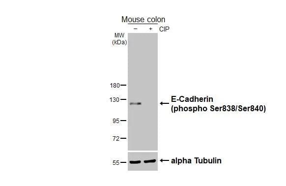 Untreated (-) and treated (+) mouse tissue extract (50 ug) were separated by 7.5% SDS-PAGE, and the membrane was blotted with E-Cadherin (phospho Ser838/840) antibody (NBP3-12922) diluted at 1:10000. The HRP-conjugated anti-rabbit IgG antibody  was used to detect the primary antibody. 