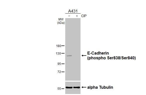 Untreated (-) and treated (+) A431 whole cell extracts (30 ug) were separated by 7.5% SDS-PAGE, and the membrane was blotted with E-Cadherin (phospho Ser838/840) antibody (NBP3-12922) diluted at 1:1000. The HRP-conjugated anti-rabbit IgG antibody  was used to detect the primary antibody. 