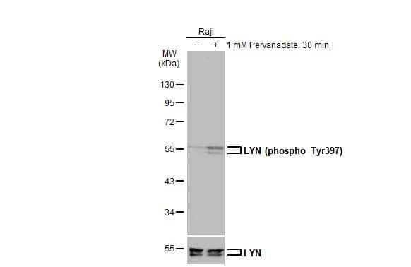 Untreated (-) and treated (+) Raji whole cell extract (30 ug) were separated by 10% SDS-PAGE, and the membrane was blotted with LYN (phospho Tyr397) antibody (NBP3-12926) diluted at 1:500. The HRP-conjugated anti-rabbit IgG antibody  was used to detect the primary antibody. 