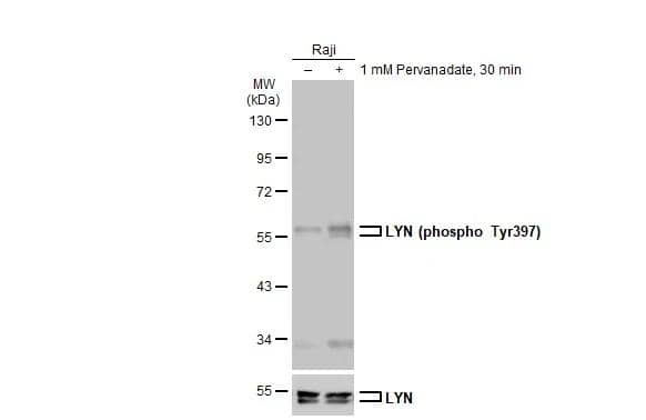 Untreated (-) and treated (+) Raji whole cell extracts (30 ug) were separated by 10% SDS-PAGE, and the membrane was blotted with LYN (phospho Tyr397) antibody (NBP3-12926) diluted at 1:500. The HRP-conjugated anti-rabbit IgG antibody  was used to detect the primary antibody. 