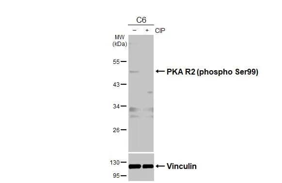 <b>Biological Strategies Validation. </b>Untreated (-) and treated (+) C6 whole cell extracts (30 ug) were separated by 10% SDS-PAGE, and the membrane was blotted with PKA R2 (phospho Ser96) antibody (NBP3-12928) diluted at 1:1000. The HRP-conjugated anti-rabbit IgG antibody  was used to detect the primary antibody, and the signal was developed with Trident ECL plus-Enhanced. 