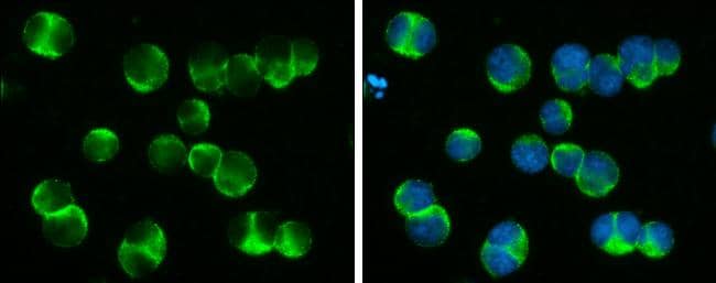 DOCK2 antibody detects DOCK2 protein at cytoplasm by immunofluorescent analysis.Sample: Jurkat cells were fixed in 4% paraformaldehyde at RT for 15 min.Green: DOCK2 protein stained by DOCK2 antibody (NBP3-12944) diluted at 1:400.Blue: Hoechst 33342 staining. 