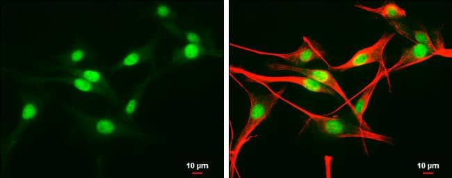 EDD antibody detects EDD protein at nucleus by immunofluorescent analysis.Sample: U87-MG cells were fixed in 4% paraformaldehyde at RT for 15 min.Green: EDD protein stained by EDD antibody (NBP3-12948) diluted at 1:500.Red: alpha Tubulin, a cytoskeleton marker, stained by alpha Tubulin antibody [GT114]  diluted at 1:1000.Blue: Hoechst 33342 staining.Scale bar = 10 um. 