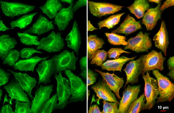 Immunocytochemistry/ Immunofluorescence: Plectin Antibody [NBP3-12950] - Plectin antibody detects Plectin protein at cytoskeleton by immunofluorescent analysis.Sample: U2OS cells were fixed in 4% paraformaldehyde at RT for 15 min.Green: Plectin stained by Plectin antibody (NBP3-12950) diluted at 1:500.Red: alpha Tubulin, a cytoskeleton marker, stained by alpha Tubulin antibody [GT114]  diluted at 1:1000.Blue: Fluoroshield with DAPI .Scale bar= 10um.