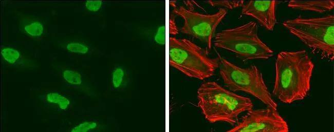 Immunocytochemistry/ Immunofluorescence SMARCA5/SNF2H Antibody