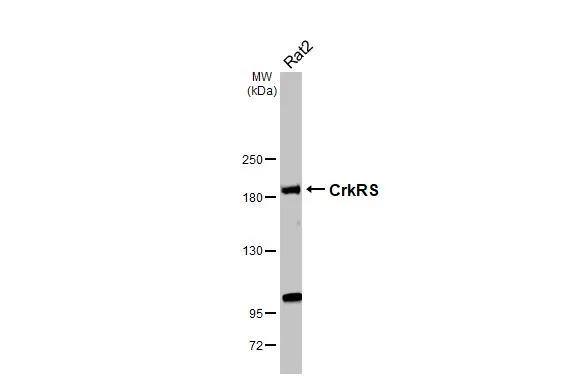 Whole cell extract (30 ug) was separated by 5% SDS-PAGE, and the membrane was blotted with CrkRS antibody (NBP3-12958) diluted at 1:1000. The HRP-conjugated anti-rabbit IgG antibody  was used to detect the primary antibody. 