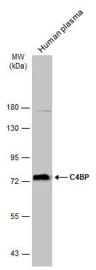 Human plasma (30 ug) was separated by 7.5% SDS-PAGE, and the membrane was blotted with C4BP antibody (NBP3-12959) diluted at 1:5000. The HRP-conjugated anti-rabbit IgG antibody  was used to detect the primary antibody. 