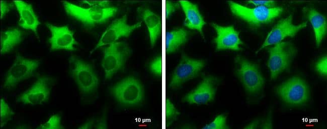 NMT1 antibody detects NMT1 protein at cytoplasm by immunofluorescent analysis.Sample: HeLa cells were fixed in 4% paraformaldehyde at RT for 15 min.Green: NMT1 protein stained by NMT1 antibody (NBP3-12963) diluted at 1:500.Blue: Hoechst 33342 staining.Scale bar = 10 um. 